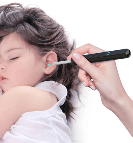 Smart Ear Cleaner with Camera iPhone & Android